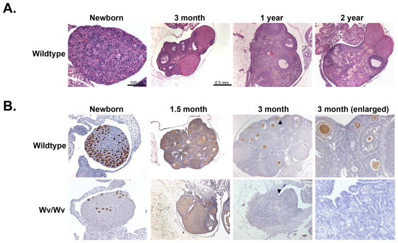 White spotting variant mouse as an experimental model for ovarian aging and menopausal biology.
